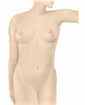 Liposuction surgery