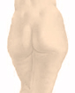 Liposuction surgery