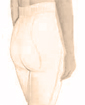 Liposuction surgery