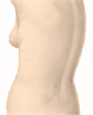 Liposuction surgery