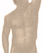 Liposuction surgery