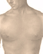 Male breast reduction surgery