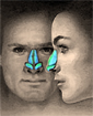 Rhinoplasty surgery