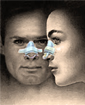 Rhinoplasty surgery
