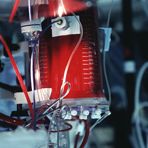 Adding nitric oxide to blood in blood banks may preserve life giving properties