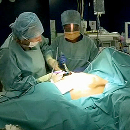 Angelica helps a young woman ‘downsize’ her implants as she tries to be taken seriously in her new career