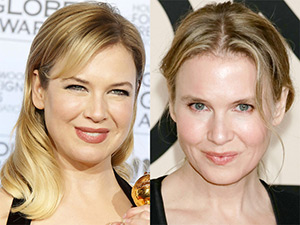It looks like Renée Zellweger has undergone an eyelid lift