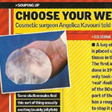 Choose your weapons. Cosmetic Surgeon Angelica Kavouni told us about implants