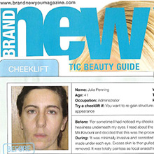 Try a cheek lift if you want to re-gain structure and heighten cheekbones