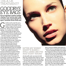 Can an injection used to combat cellulite cure puffy eyes?