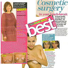 10 minutes facelifts, lunchtime lipo and breast fillers