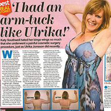 Kate Southwell hated her bingo wings so much that she underwent a painful cosmetic surgery