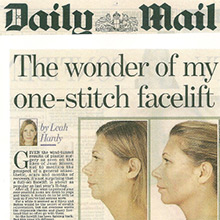 The wonder of my one stitch facelift, it's the ultimate quick fix for turkey necks
