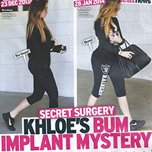 In just five weeks, Khloe‘s got a new bum.