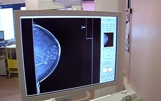 Ms Angelica Kavouni on Embarrassing Bodies - Macrolane Breast Augmentation