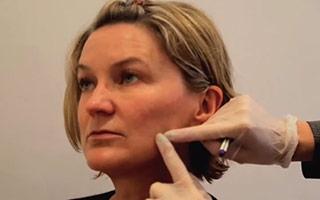 Short scar facelift procedure explained by Ms Angelica Kavouni 
