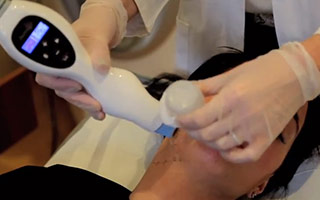 Thermage CPT therapy explained by Ms Angelica Kavouni