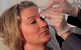 Botulinium Toxin Wrinkle Relaxation with Ms Angelica Kavouni